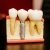 dental examples that create waste